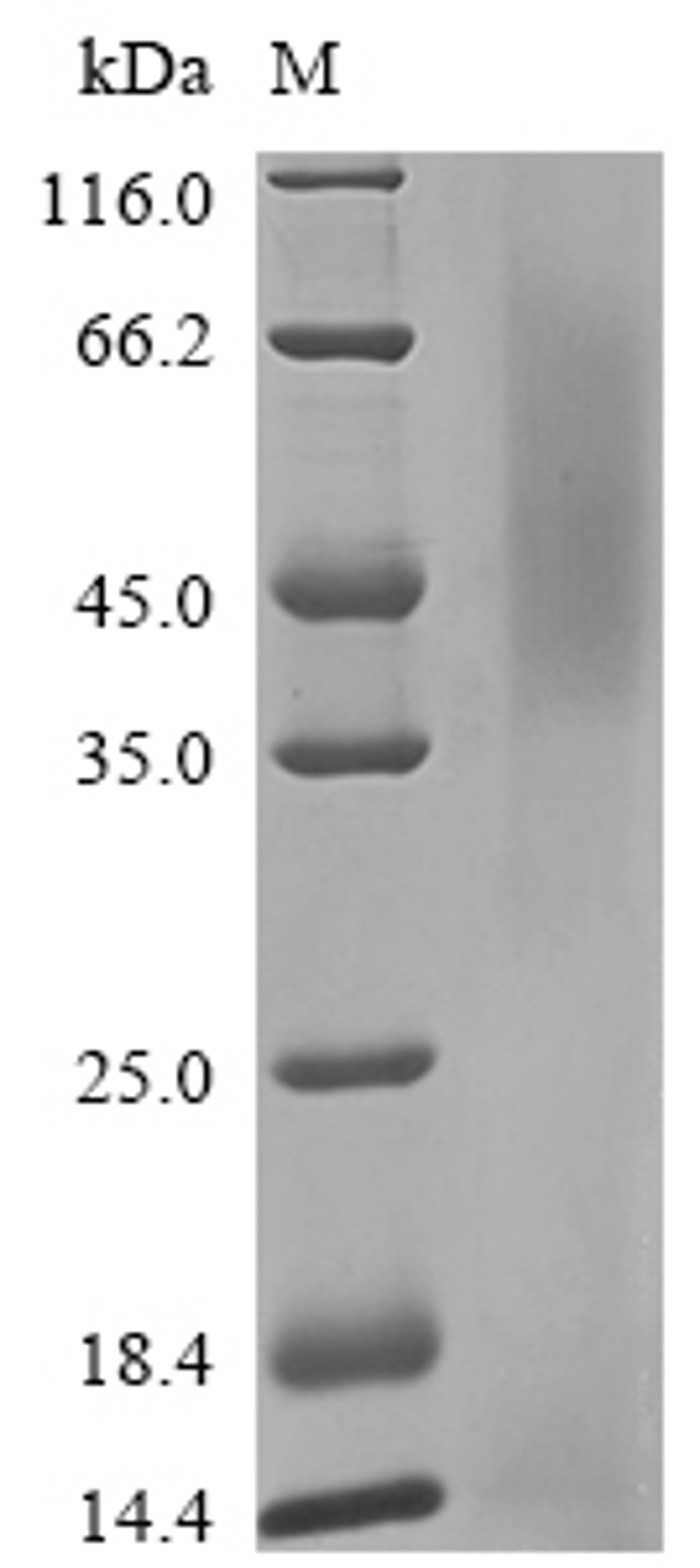 (Tris-Glycine gel) Discontinuous SDS-PAGE (reduced) with 5% enrichment gel and 15% separation gel.