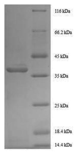 (Tris-Glycine gel) Discontinuous SDS-PAGE (reduced) with 5% enrichment gel and 15% separation gel.