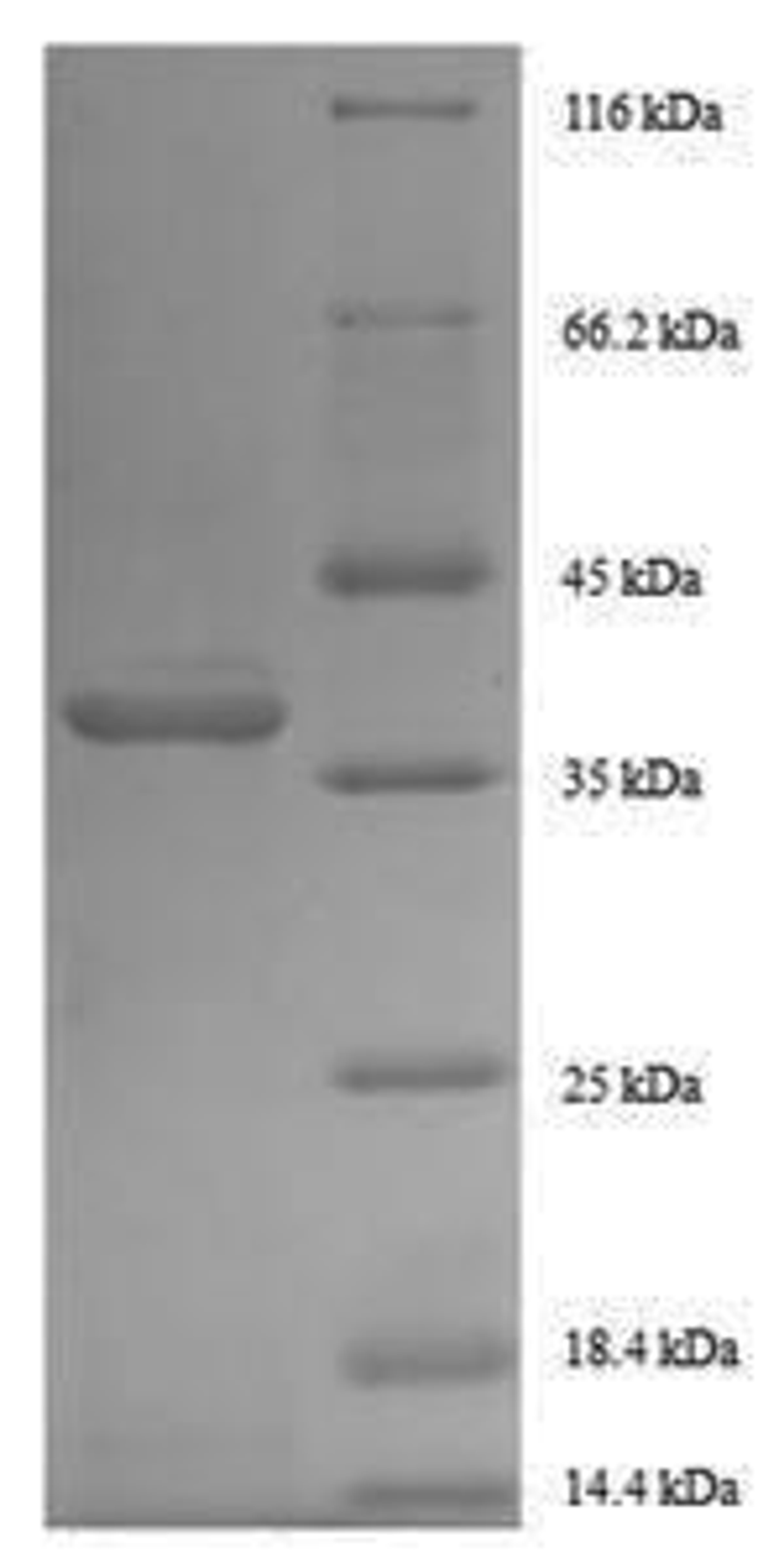 (Tris-Glycine gel) Discontinuous SDS-PAGE (reduced) with 5% enrichment gel and 15% separation gel.