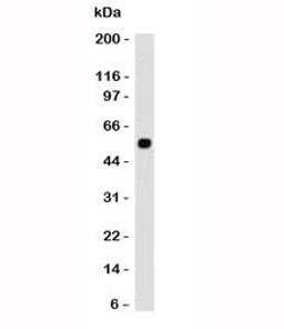 Western blot testing of human samples with p53 antibody (CTA53-1).