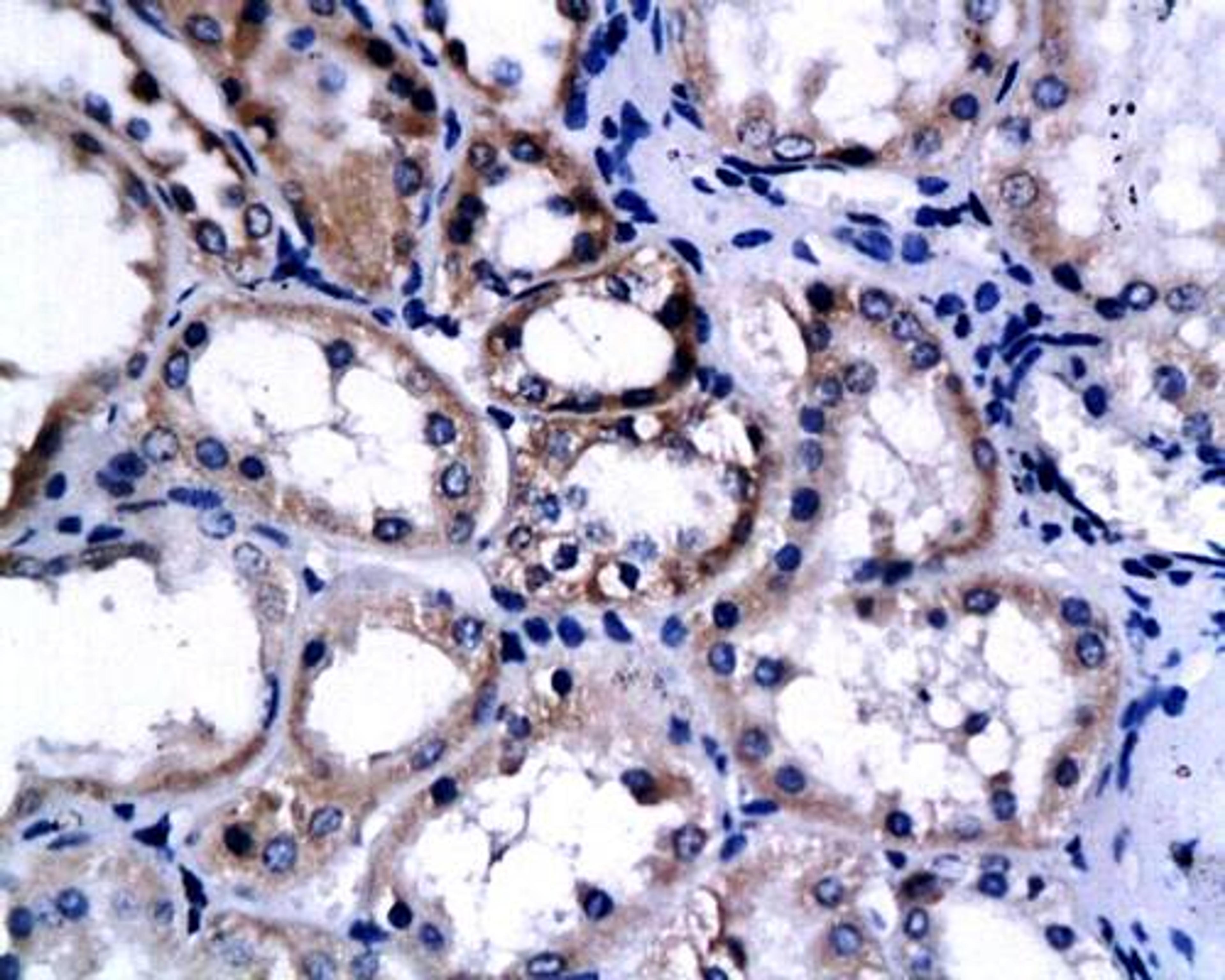 Immunohistochemical analysis of paraffin-embedded human renal cell carcinoma using Endostatin antibody 