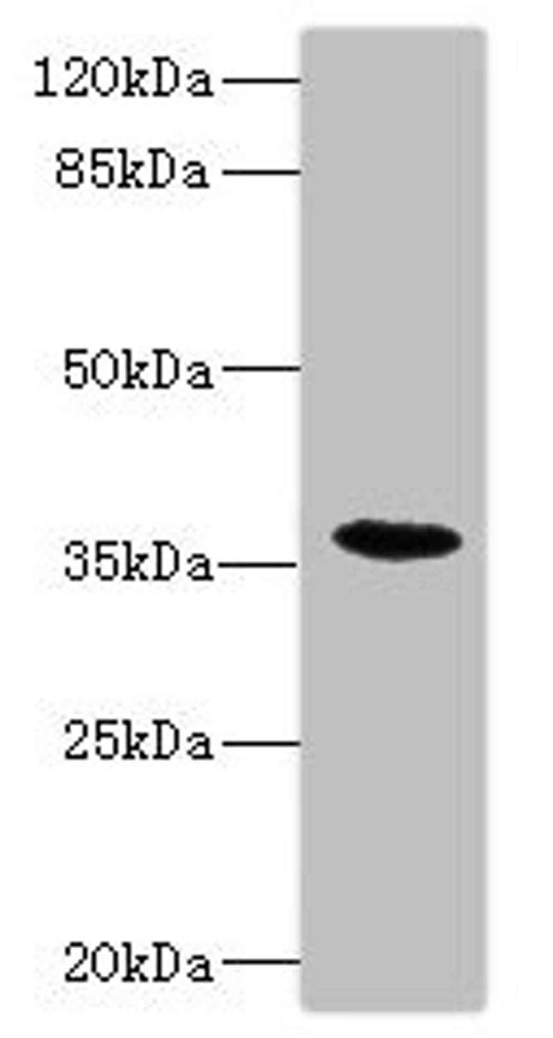 Western blot. All lanes: BST1 antibody IgG at 1.47ug/ml + Mouse lung tissue. Secondary. Goat polyclonal to rabbit IgG at 1/10000 dilution. Predicted band size: 36, 30 kDa. Observed band size: 36 kDa.