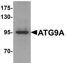 Western blot analysis of mouse heart tissue lysate probed with Rabbit anti Human ATG9A (AHP2248)