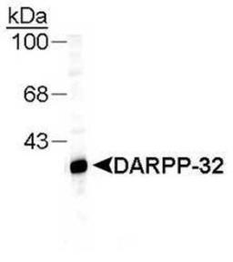 Western Blot: DARPP32 Antibody [NB300-304] - Detection of DARPP protein in rat hippocampal lysate using NB 300-304.