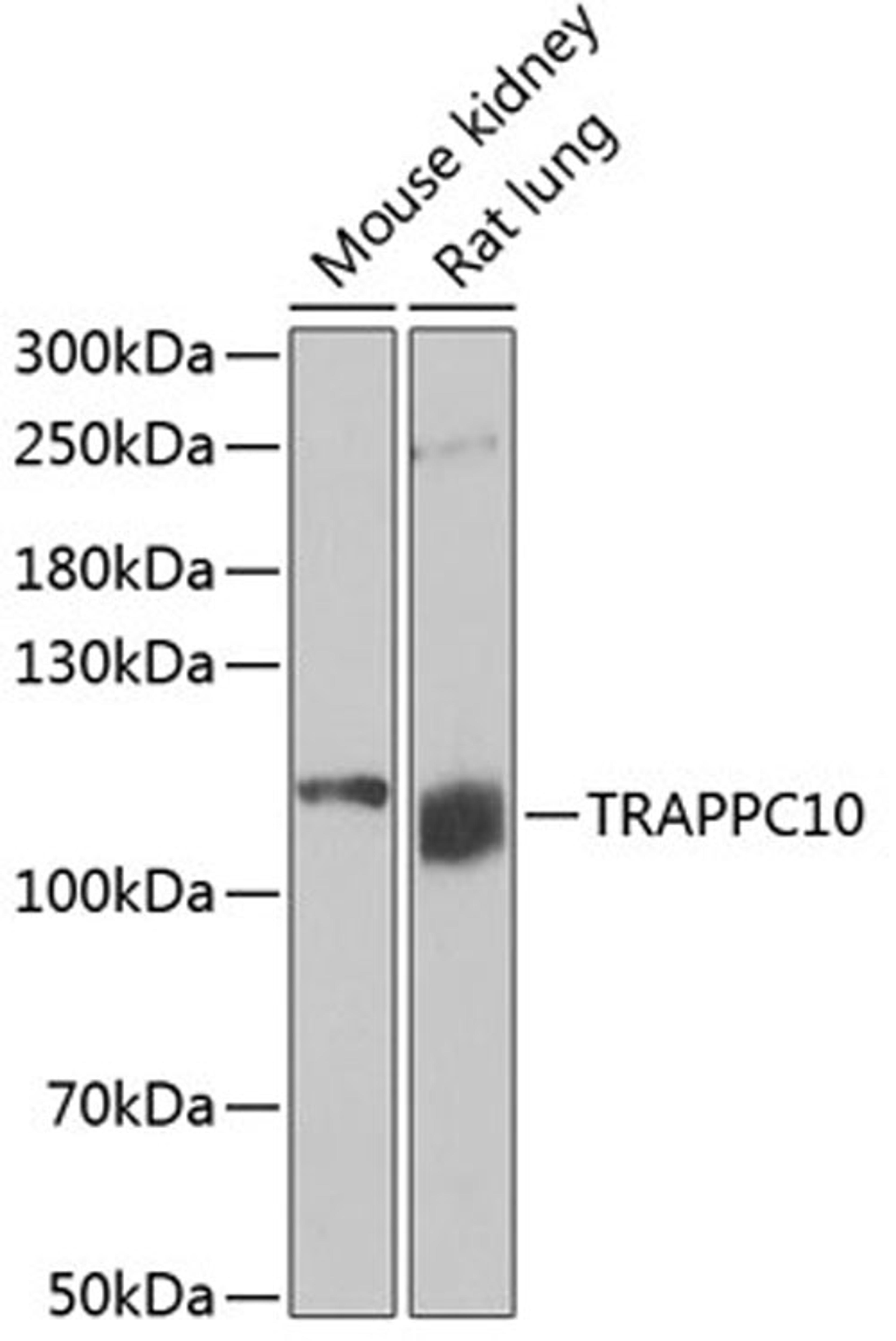 Western blot - TRAPPC10 antibody (A6777)