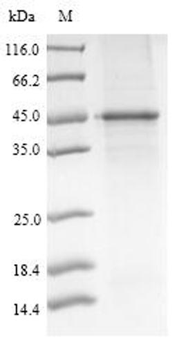 (Tris-Glycine gel) Discontinuous SDS-PAGE (reduced) with 5% enrichment gel and 15% separation gel.
