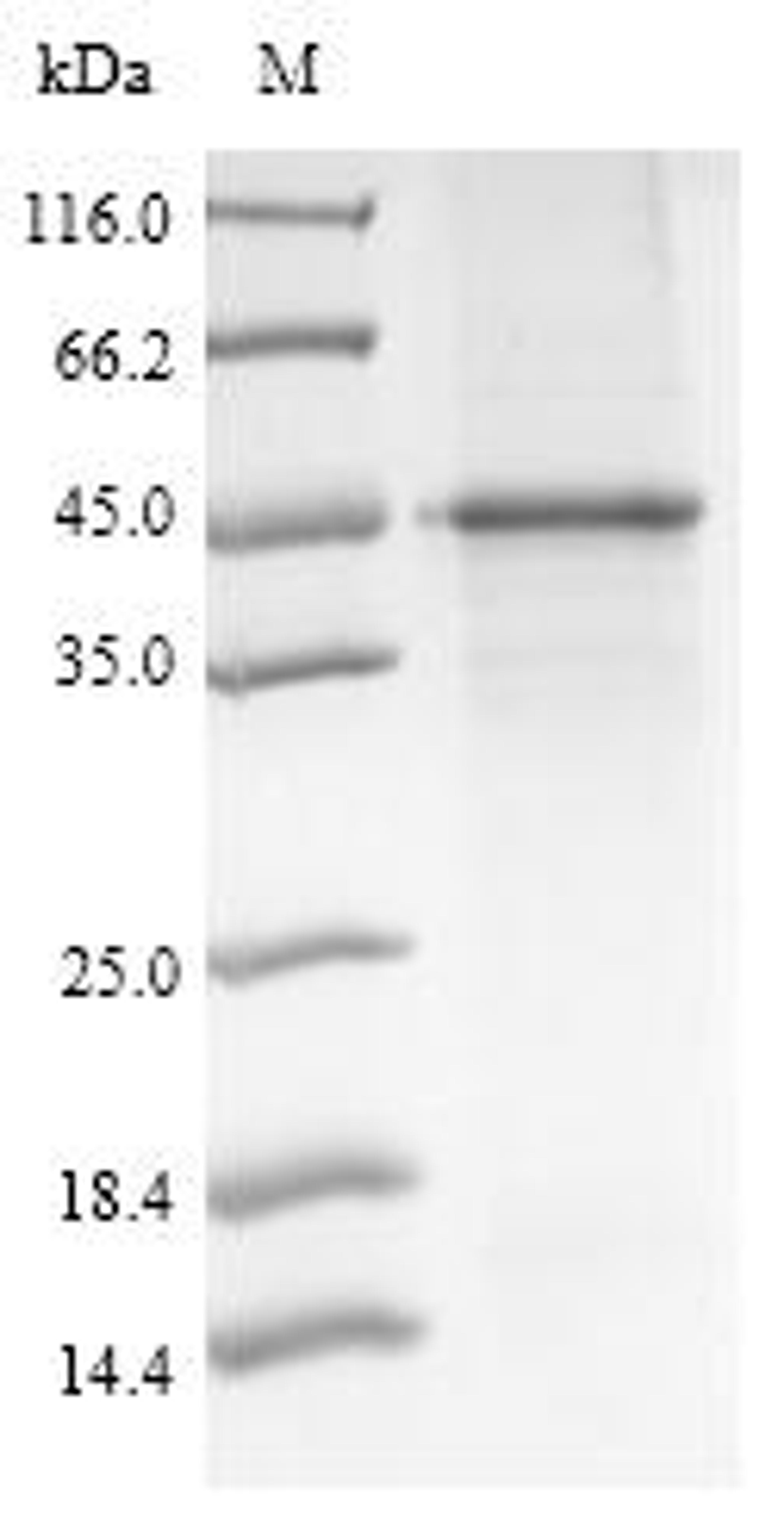 (Tris-Glycine gel) Discontinuous SDS-PAGE (reduced) with 5% enrichment gel and 15% separation gel.