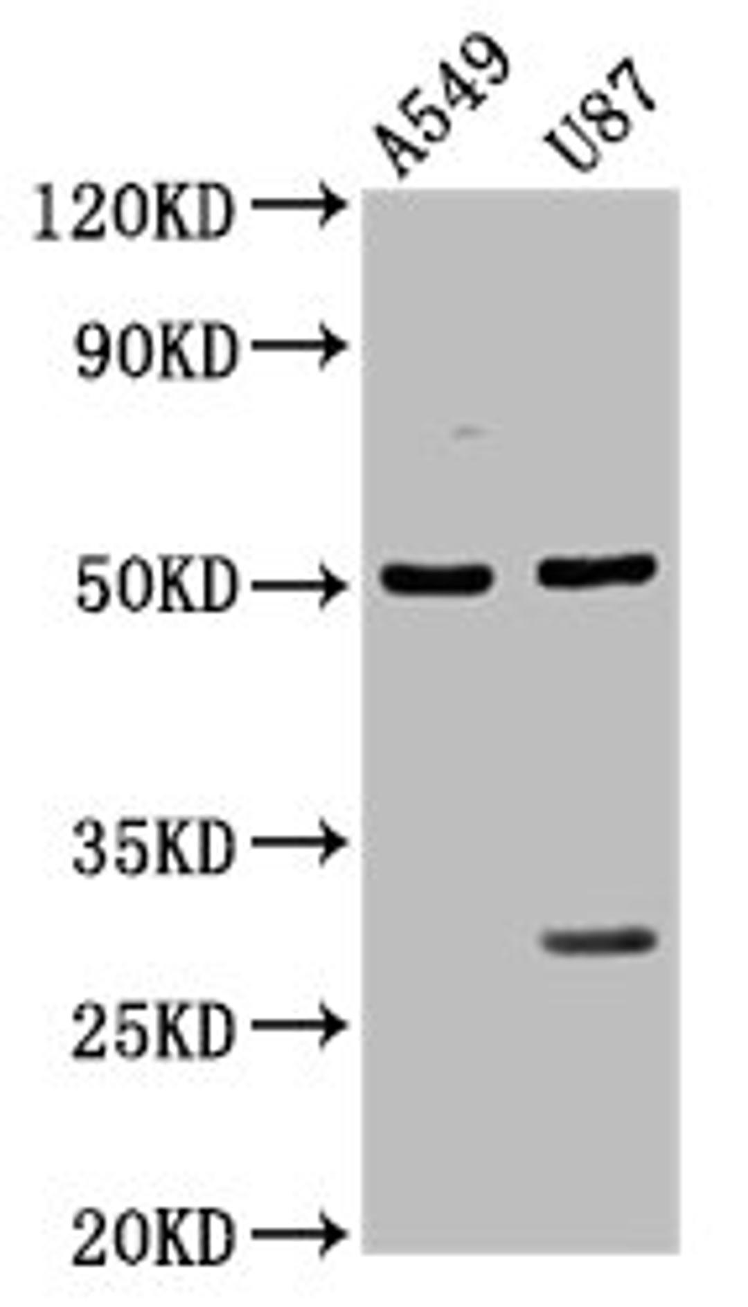 Western Blot. Positive WB detected in: A549 whole cell lysate, U87 whole cell lysate. All lanes: LANCL2 antibody at 3.5µg/ml. Secondary. Goat polyclonal to rabbit IgG at 1/50000 dilution. Predicted band size: 51 kDa. Observed band size: 51 kDa