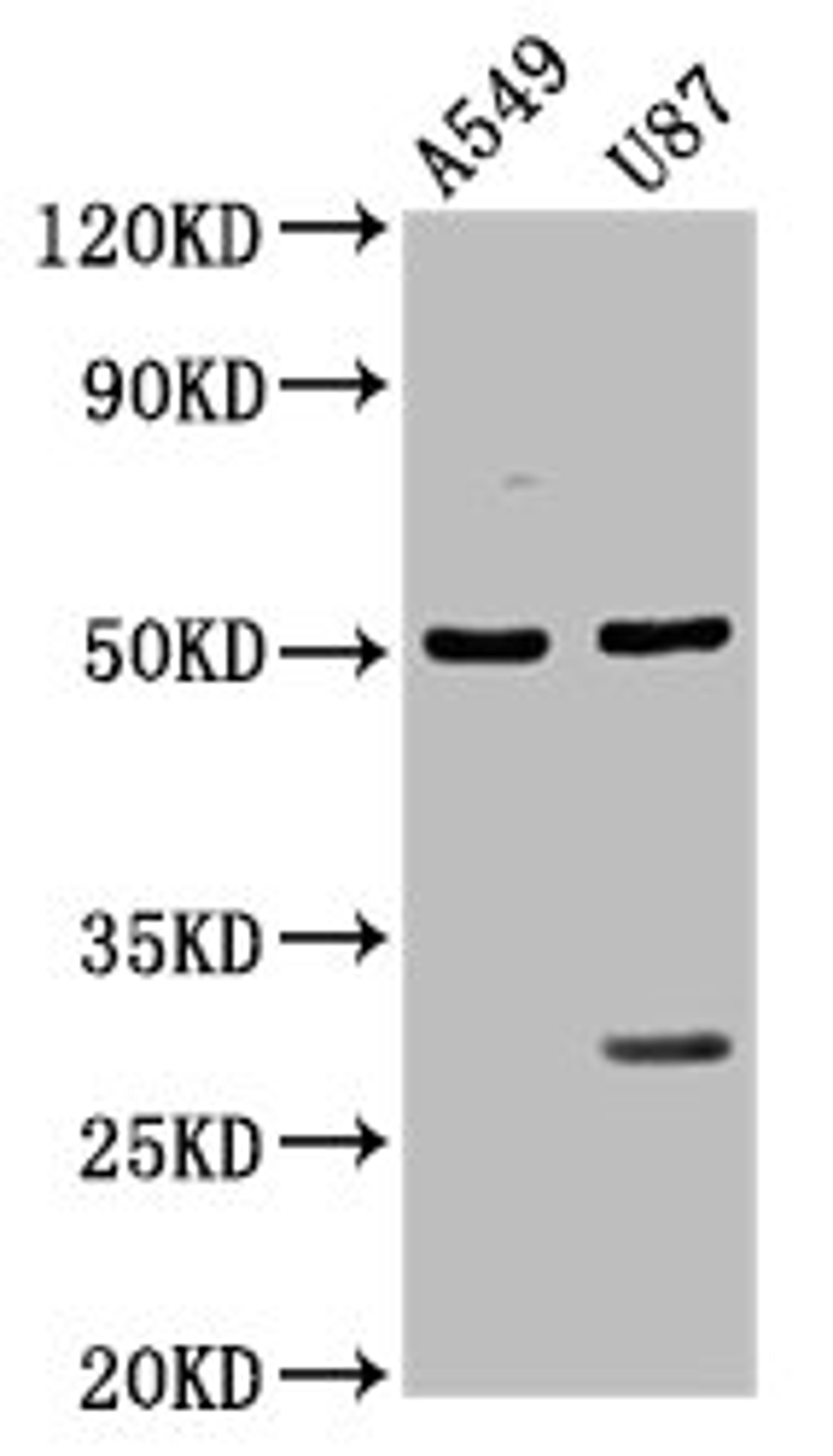 Western Blot. Positive WB detected in: A549 whole cell lysate, U87 whole cell lysate. All lanes: LANCL2 antibody at 3.5µg/ml. Secondary. Goat polyclonal to rabbit IgG at 1/50000 dilution. Predicted band size: 51 kDa. Observed band size: 51 kDa