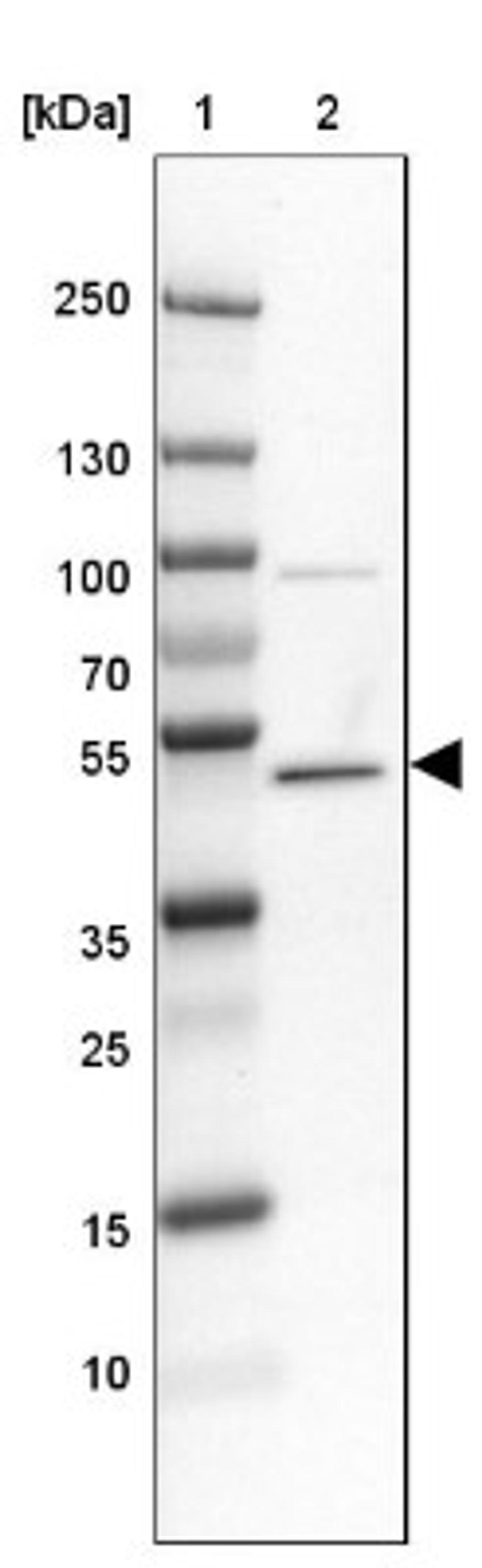 Western Blot: CNOT6L Antibody [NBP1-84186] - Lane 1: Marker [kDa] 250, 130, 100, 70, 55, 35, 25, 15, 10<br/>Lane 2: MOLT-4