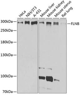 Western blot - FLNB antibody (A2481)