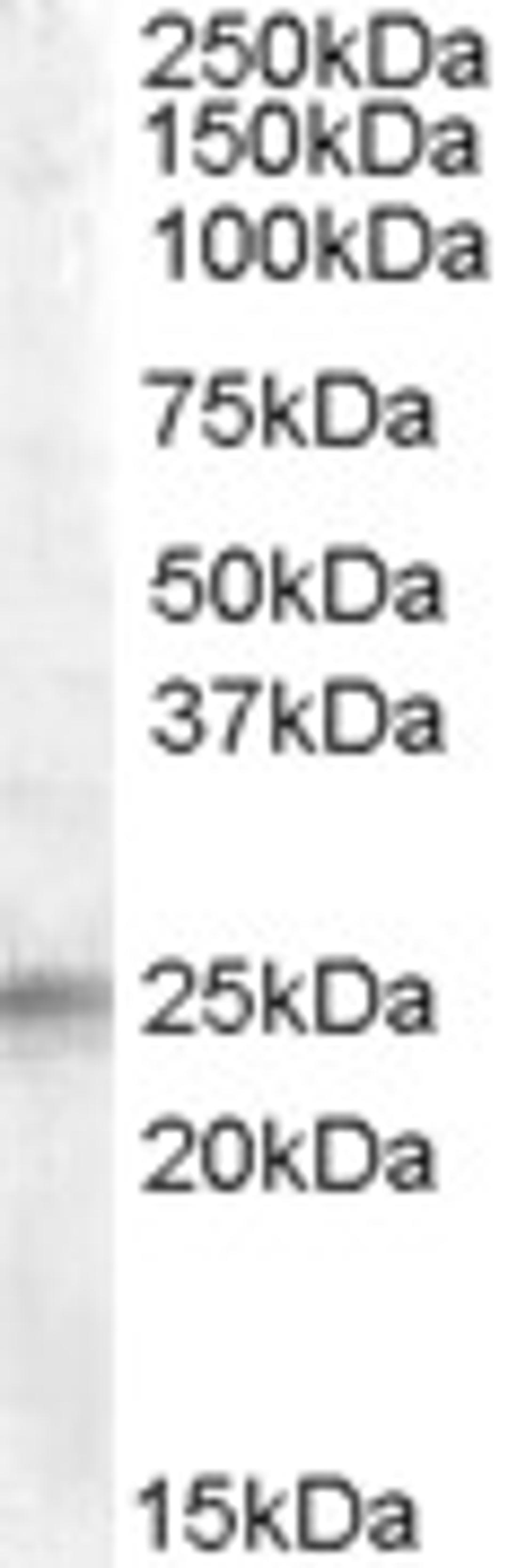 45-764 (0.5ug/ml) staining of Human Adrenal Gland lysate (35ug protein in RIPA buffer). Primary incubation was 1 hour. Detected by chemiluminescence.