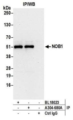 Detection of human NOB1 by western blot of immunoprecipitates.