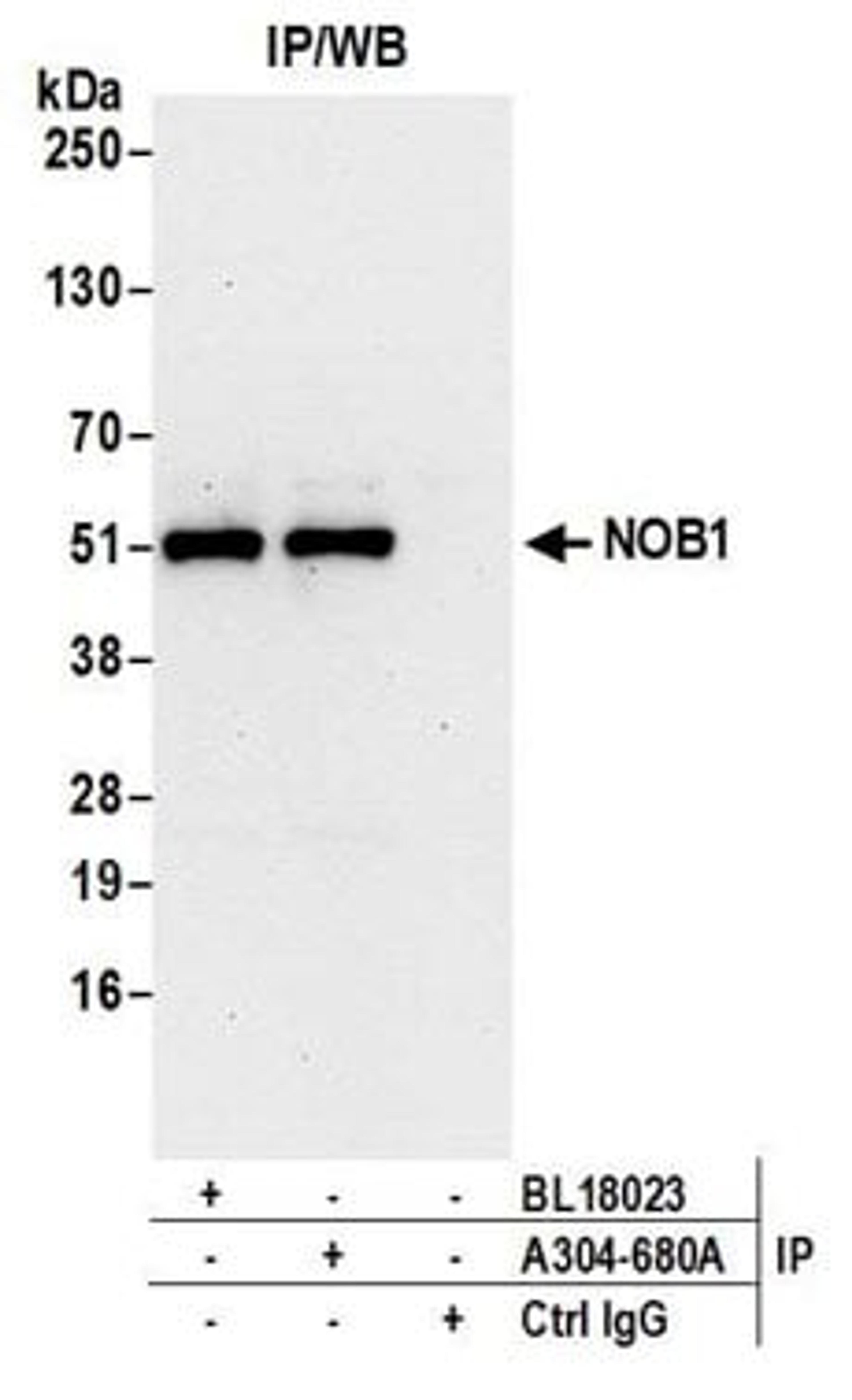 Detection of human NOB1 by western blot of immunoprecipitates.