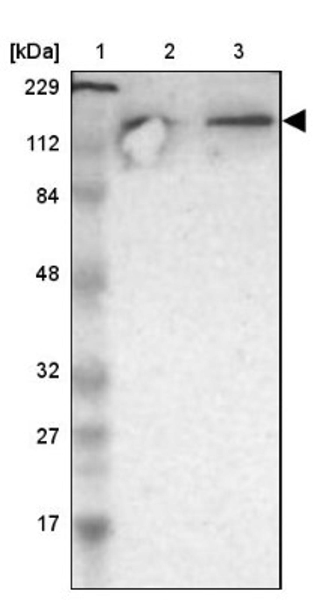 Western Blot: UBPY/USP8 Antibody [NBP1-89643] - Lane 1: Marker [kDa] 229, 112, 84, 48, 32, 27, 17<br/>Lane 2: Human cell line RT-4<br/>Lane 3: Human cell line U-251MG sp