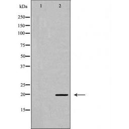 Western blot analysis of K562 cell using Myosin regulatory light chain 2 (Phospho-Ser18) antibody