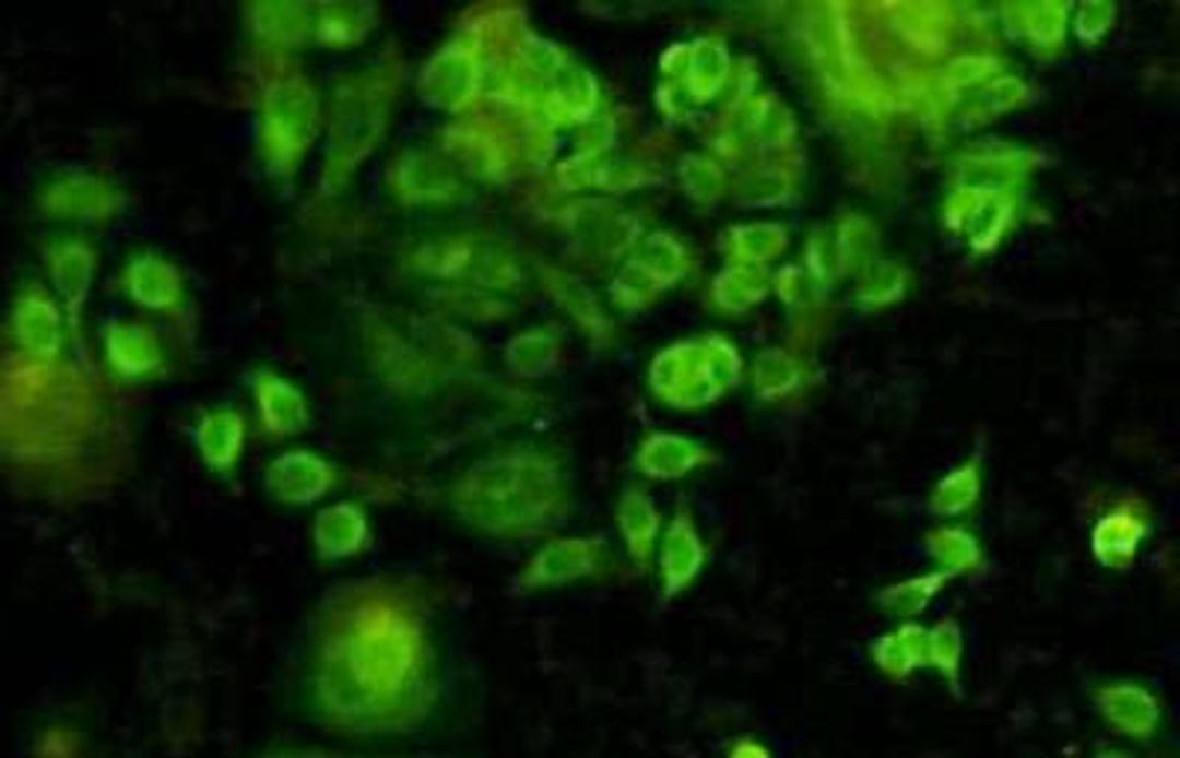 Immunofluorescent staining of MCF-7 (green) Cells using STAT1 antibody