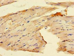 Immunohistochemistry of paraffin-embedded human skeletal muscle tissue using CSB-PA019179LA01HU at dilution of 1:100