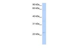 Antibody used in WB on Human HeLa at 1 ug/ml.