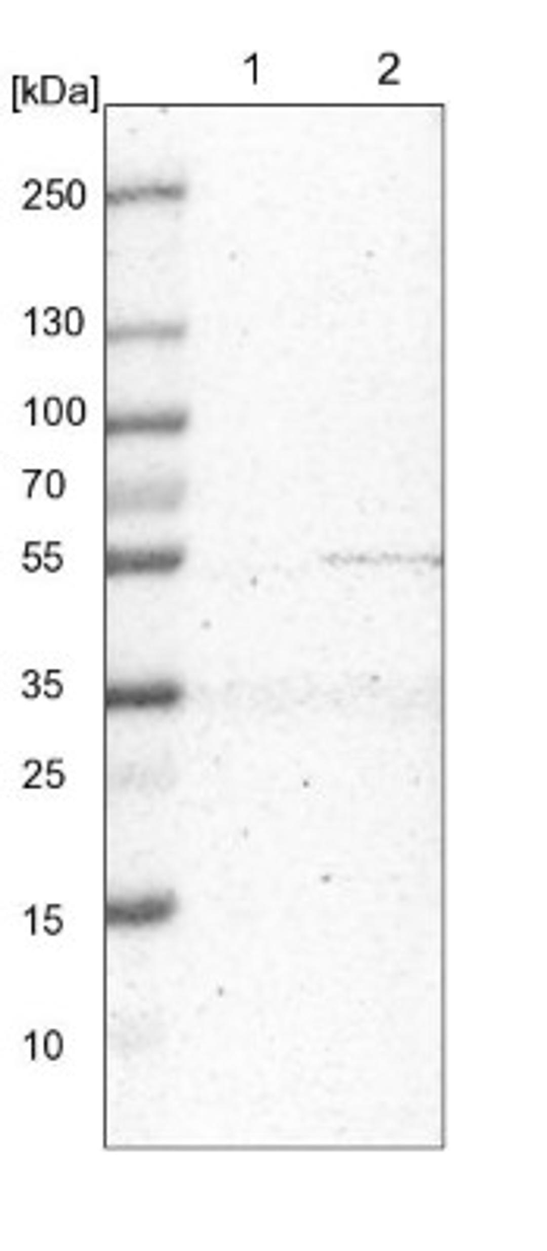 Western Blot: MRPS30 Antibody [NBP1-87343] - Lane 1: NIH-3T3 cell lysate (Mouse embryonic fibroblast cells)<br/>Lane 2: NBT-II cell lysate (Rat Wistar bladder tumour cells)