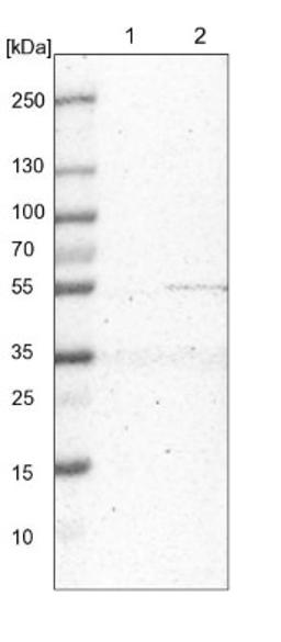 Western Blot: MRPS30 Antibody [NBP1-87343] - Lane 1: NIH-3T3 cell lysate (Mouse embryonic fibroblast cells)<br/>Lane 2: NBT-II cell lysate (Rat Wistar bladder tumour cells)