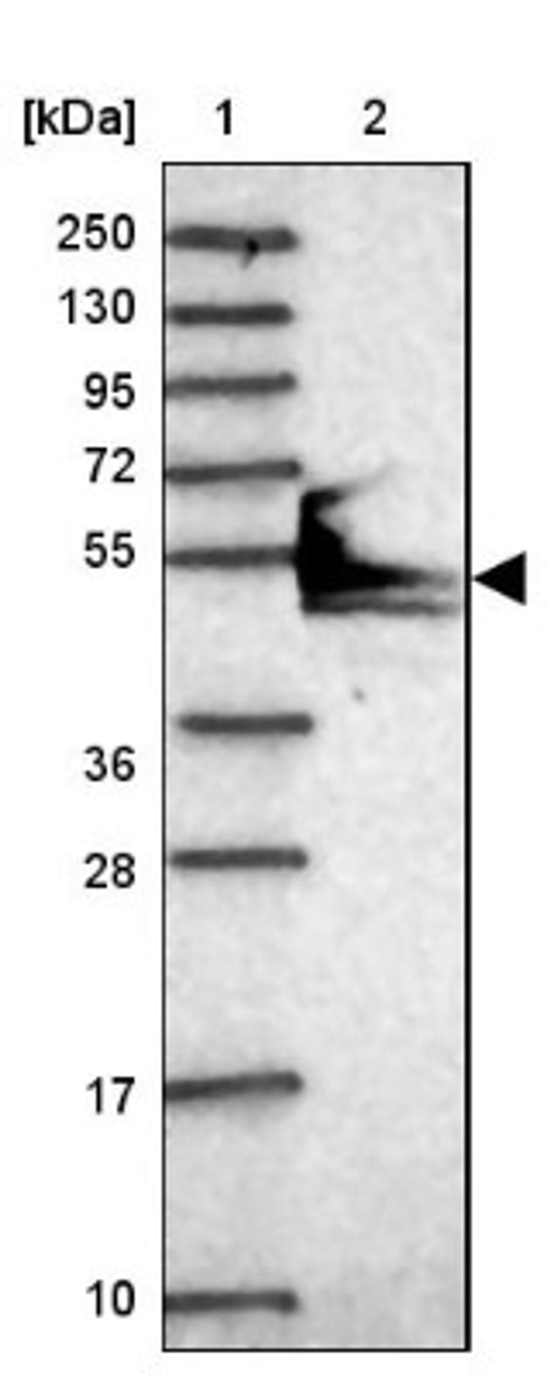 Western Blot: PDHA2 Antibody [NBP2-33922] - Lane 1: Marker [kDa] 250, 130, 95, 72, 55, 36, 28, 17, 10<br/>Lane 2: Human cell line RT-4