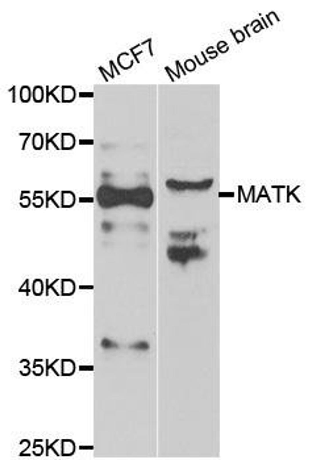 Western blot analysis of extracts of various cell lines using MATK antibody