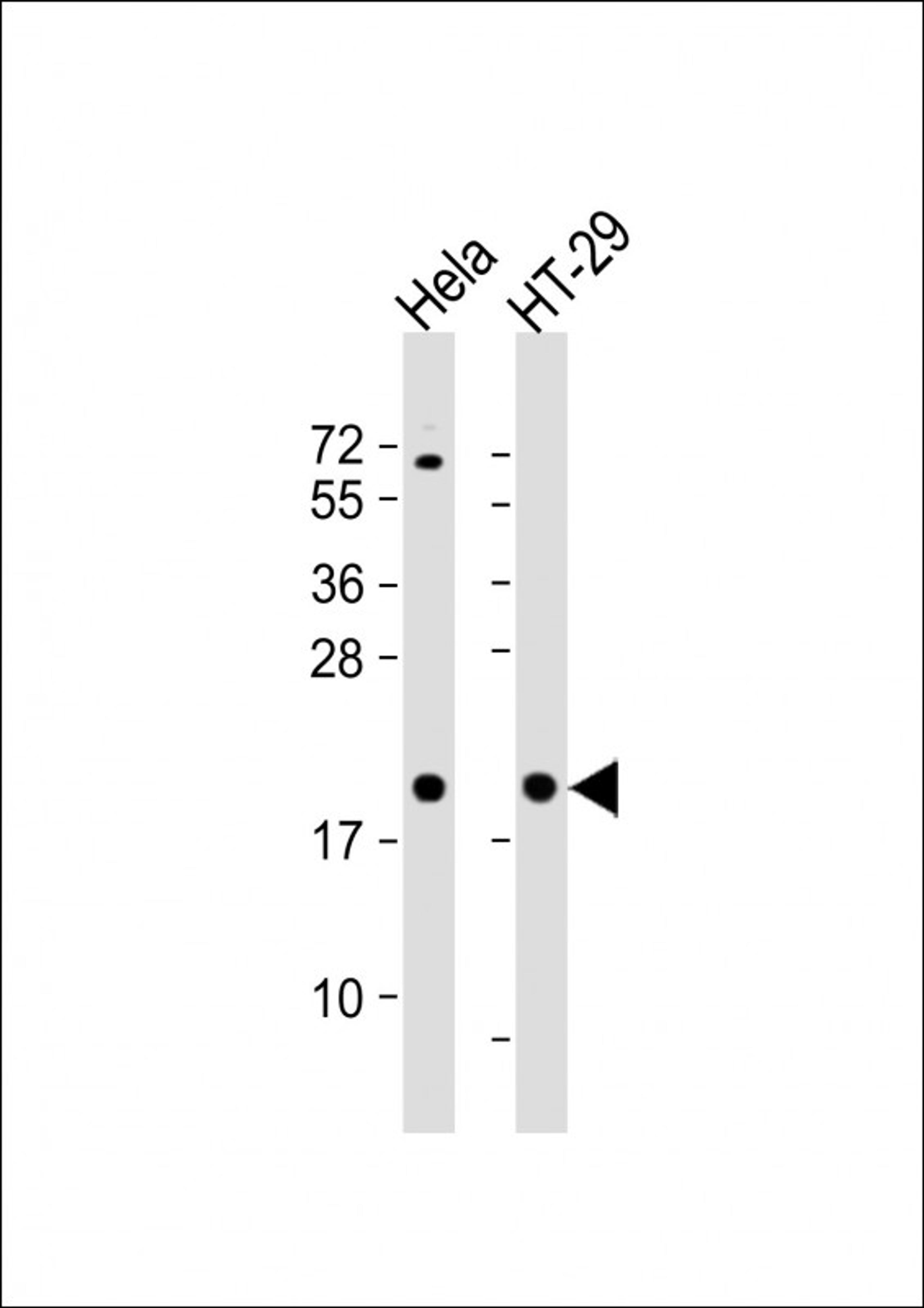 Western Blot at 1:1000 dilution Lane 1: Hela whole cell lysate Lane 2: HT-29 whole cell lysate Lysates/proteins at 20 ug per lane.