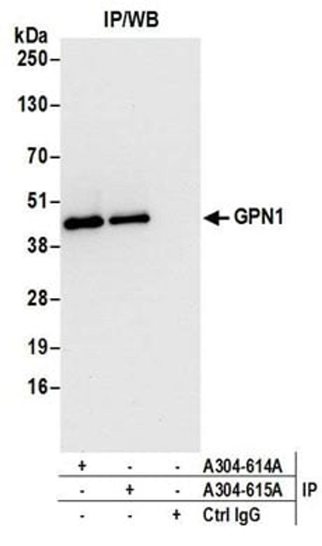 Detection of human GPN1 by western blot of immunoprecipitates.