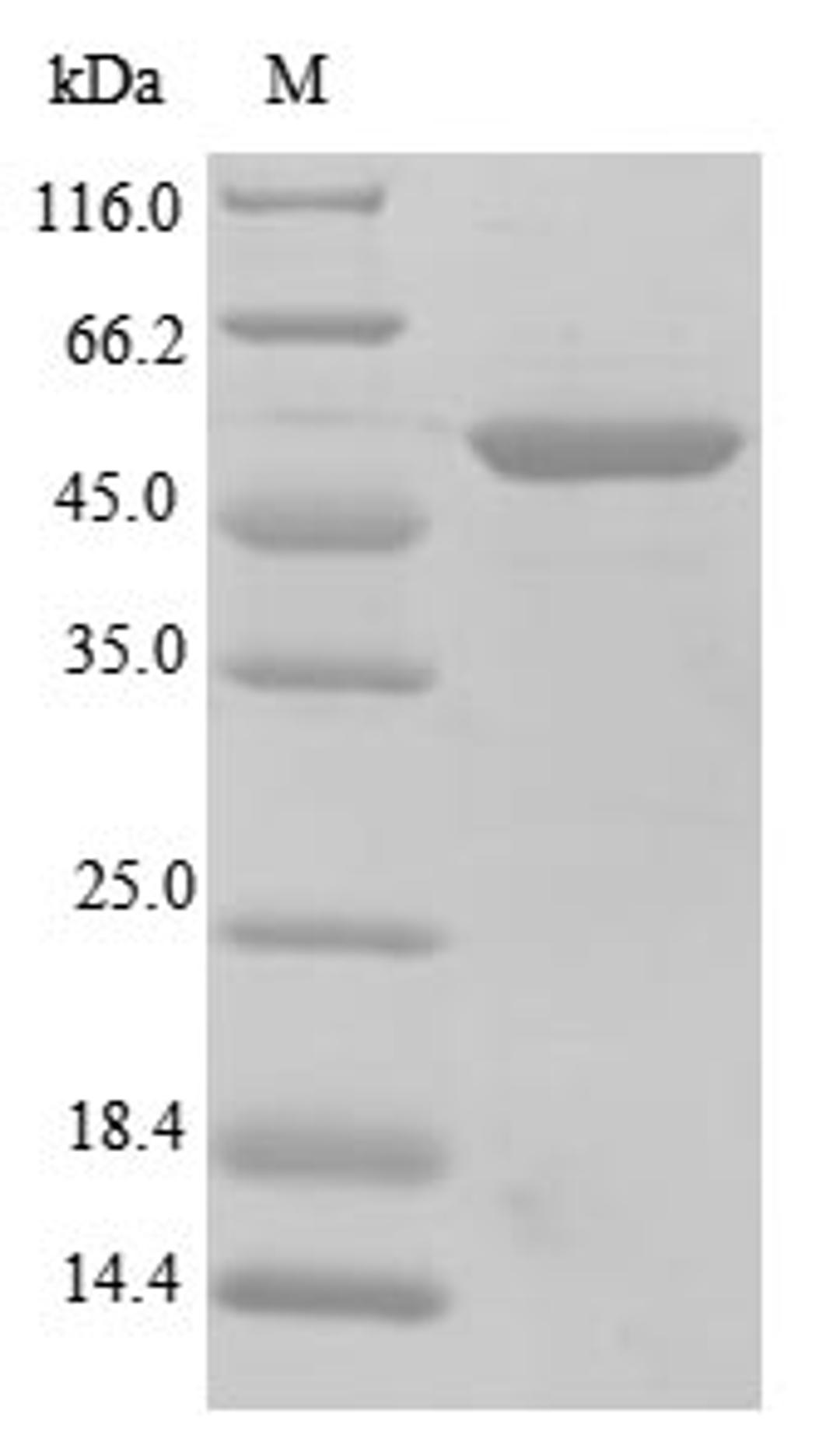 (Tris-Glycine gel) Discontinuous SDS-PAGE (reduced) with 5% enrichment gel and 15% separation gel.