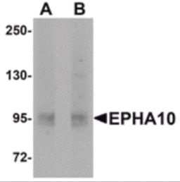 Western blot analysis of EphA10 in 293 cell lysate with EphA10 antibody at (A) 1 &#956;g/mL and (B) 2 &#956;g/mL.