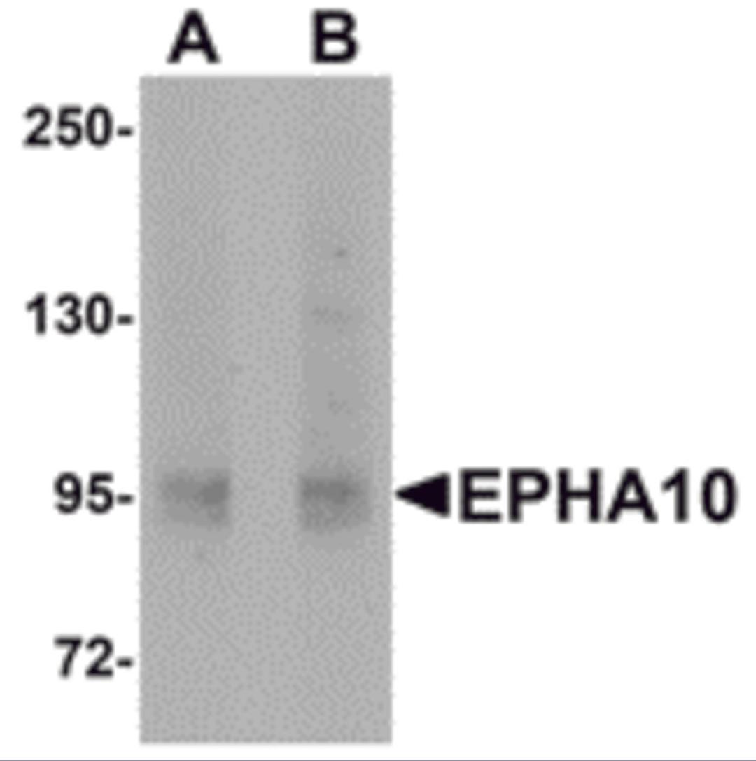 Western blot analysis of EphA10 in 293 cell lysate with EphA10 antibody at (A) 1 μg/mL and (B) 2 μg/mL.
