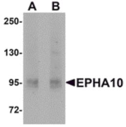 Western blot analysis of EphA10 in 293 cell lysate with EphA10 antibody at (A) 1 μg/mL and (B) 2 μg/mL.
