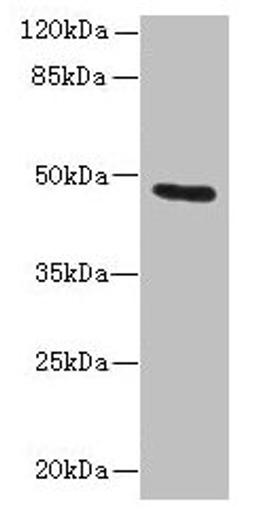 Western blot. All lanes: KRT33B antibody at 1µg/ml + MCF-7 whole cell lysate. Secondary. Goat polyclonal to rabbit IgG at 1/10000 dilution. Predicted band size: 47 kDa. Observed band size: 47 kDa