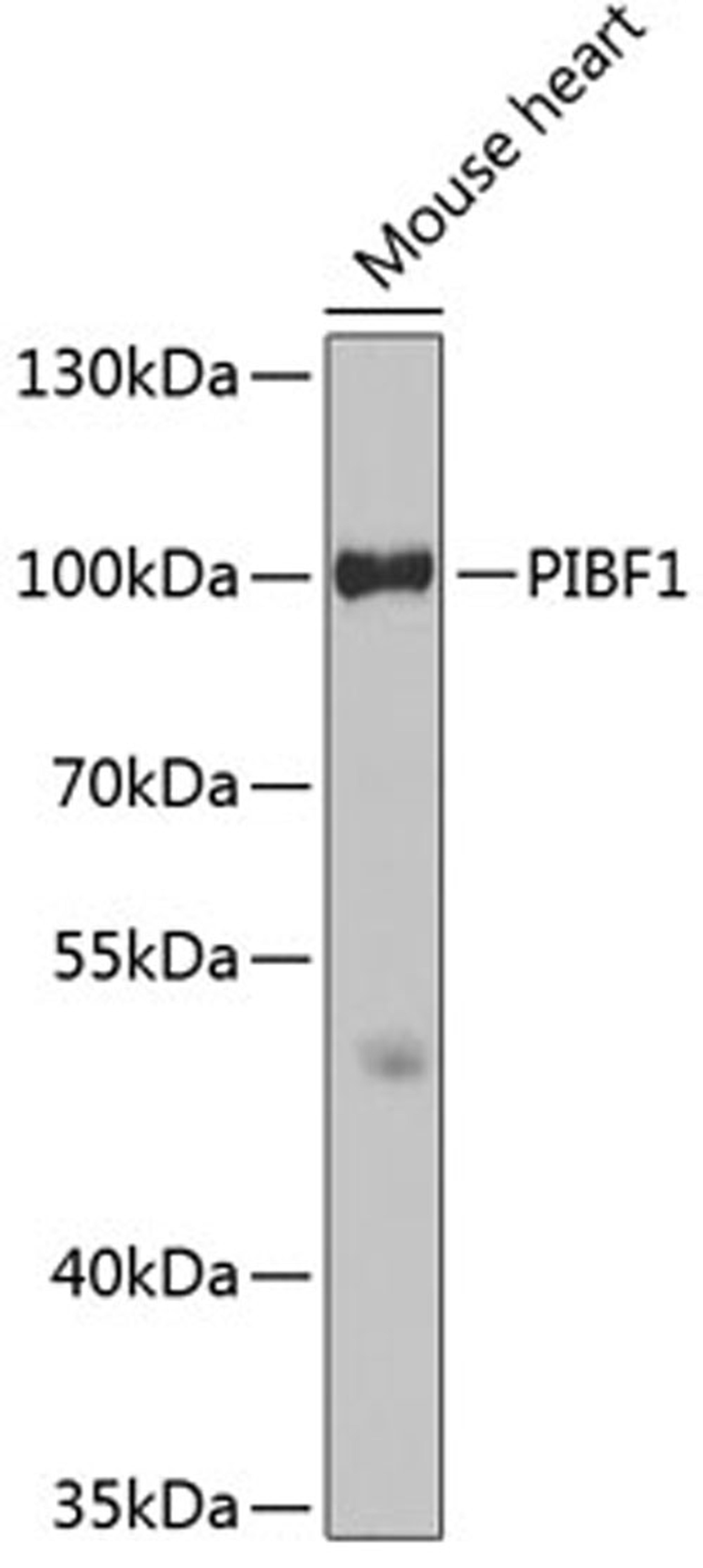 Western blot - PIBF1 antibody (A3072)