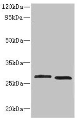 Western blot. All lanes: CRYBB1 antibody at 1.58µg/ml. Lane 1: MCF-7 whole cell lysate. Lane 2: Mouse kidney tissue. Secondary. Goat polyclonal to Rabbit IgG at 1/10000 dilution. Predicted band size: 28 kDa. Observed band size: 28 kDa