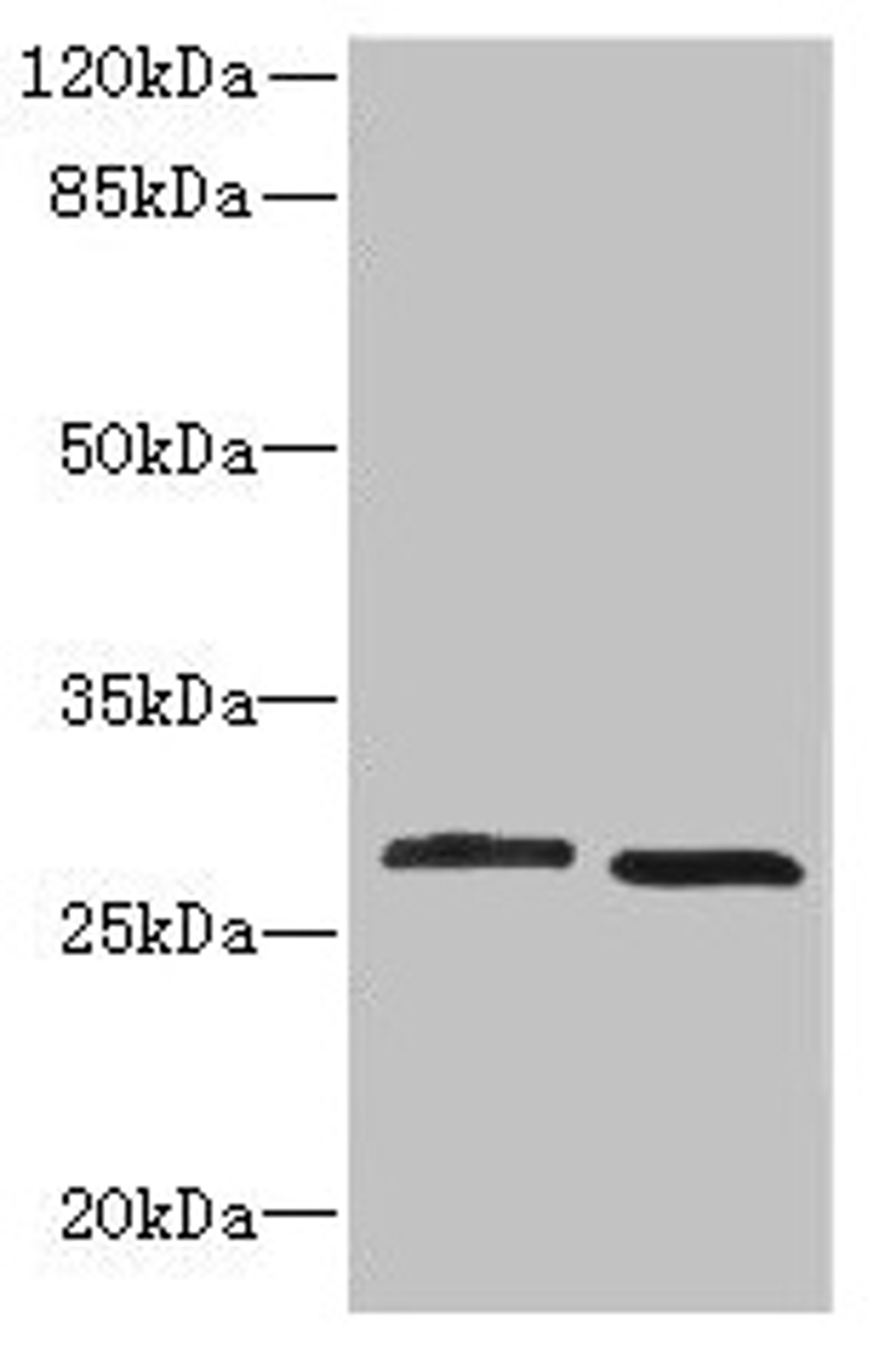 Western blot. All lanes: CRYBB1 antibody at 1.58µg/ml. Lane 1: MCF-7 whole cell lysate. Lane 2: Mouse kidney tissue. Secondary. Goat polyclonal to Rabbit IgG at 1/10000 dilution. Predicted band size: 28 kDa. Observed band size: 28 kDa