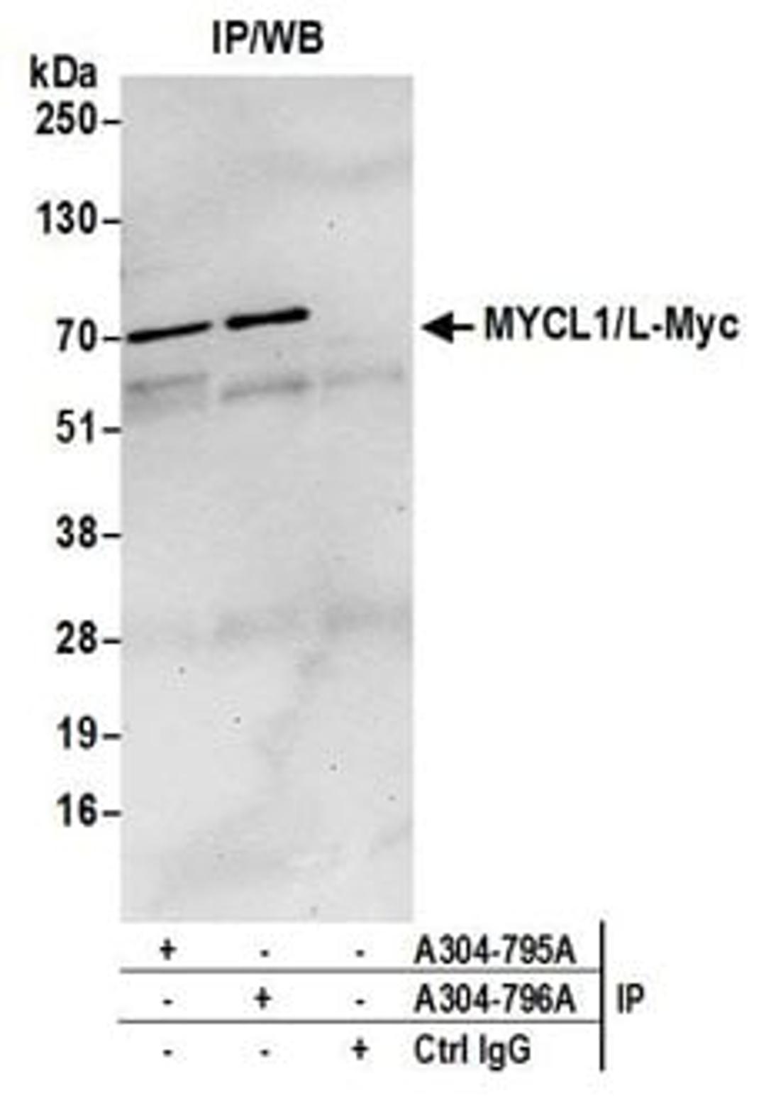 Detection of human MYCL1/L-Myc by western blot of immunoprecipitates.