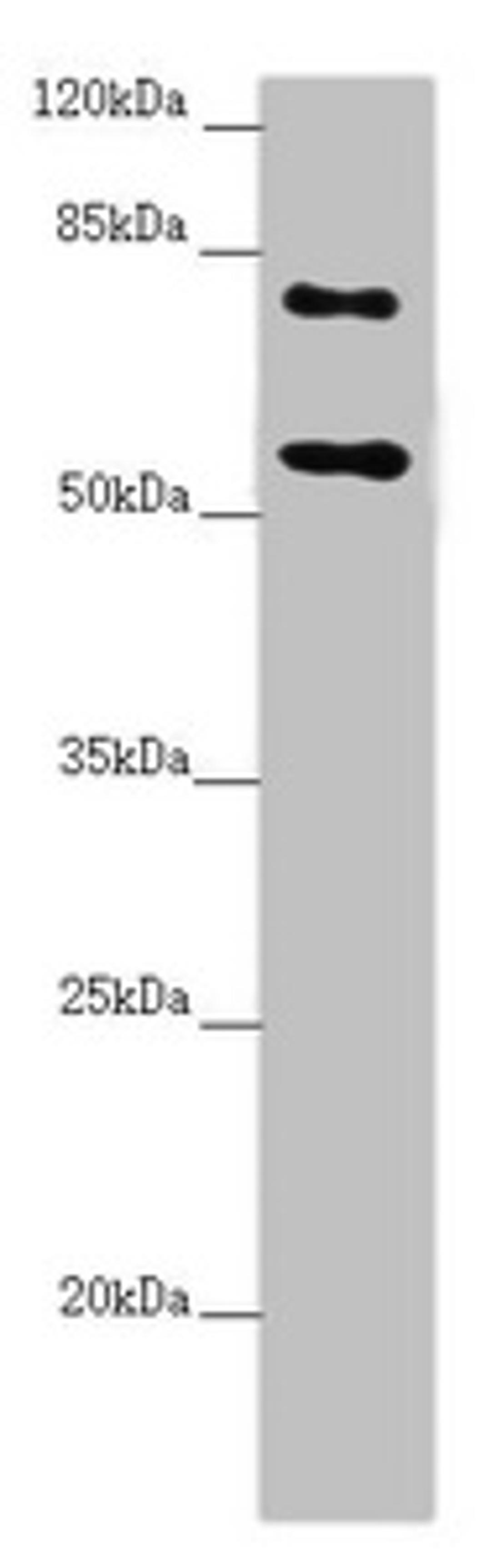 Western blot. All lanes: CEP83 antibody at 2.41 ug/ml + Raji whole cell lysate. Secondary. Goat polyclonal to rabbit IgG at 1/10000 dilution. Predicted band size: 83, 68 kDa. Observed band size: 83, 55 kDa. 