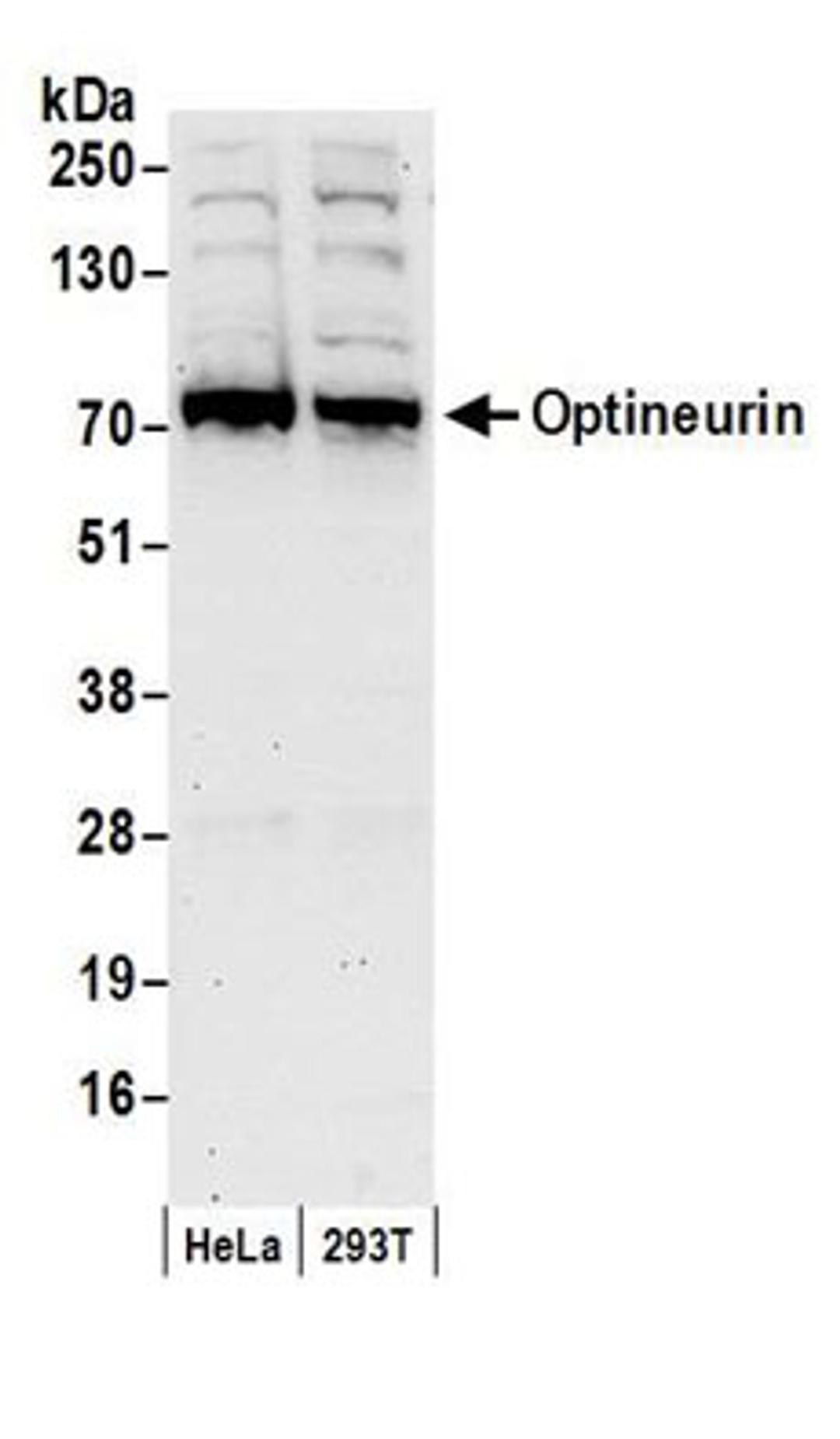 Detection of human Optineurin by western blot.