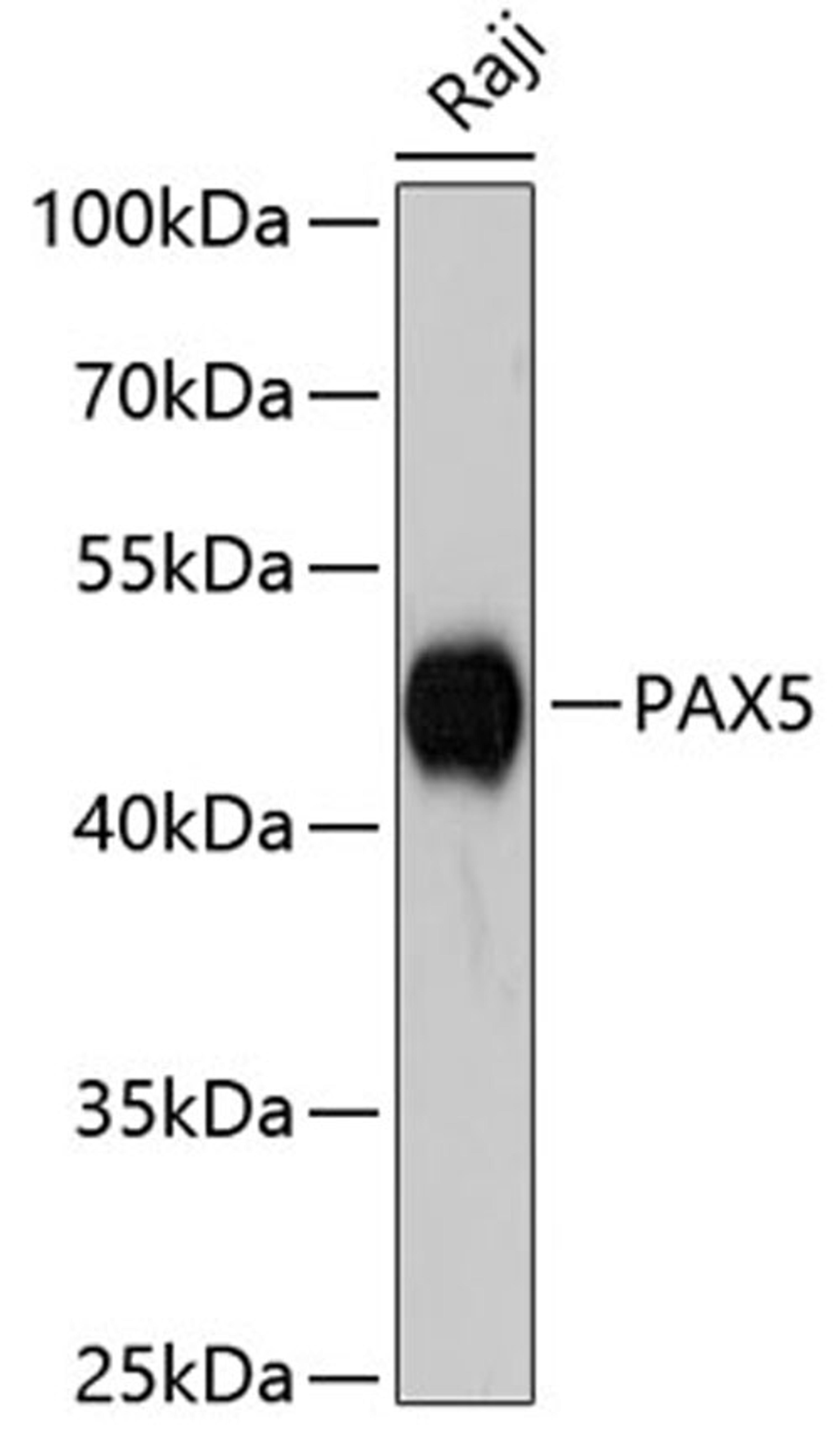 Western blot - PAX5 antibody (A3068)