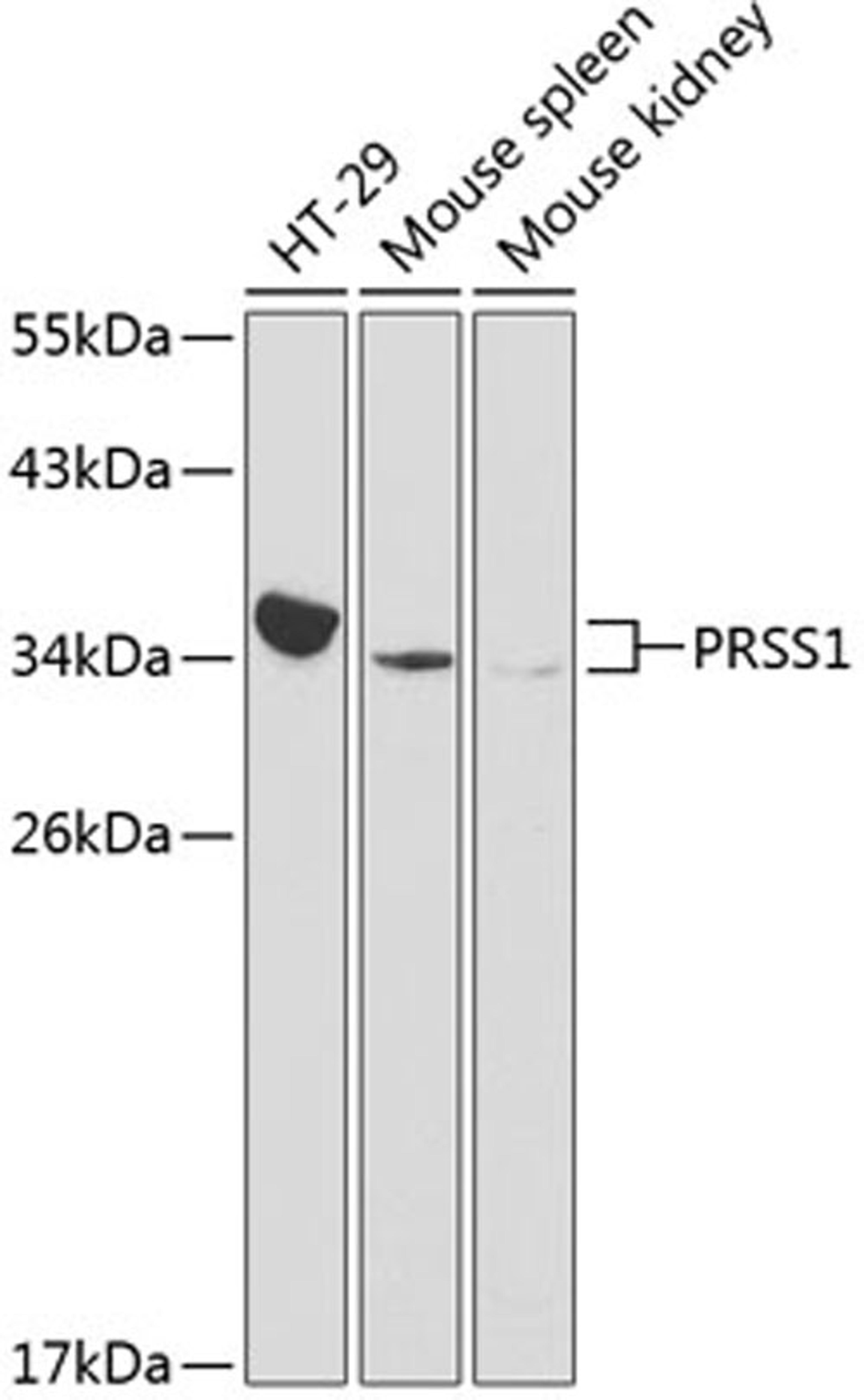 Western blot - PRSS1 antibody (A1242)