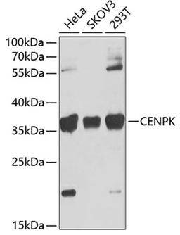 Western blot - CENPK Antibody (A7627)