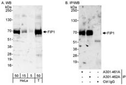 Detection of human FIP1 by western blot and immunoprecipitation.