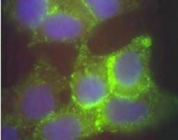 Immunocytochemistry/Immunofluorescence: Jagged 1 Antibody [NB600-1161] - Human corneal epithelial cells. Primary  antibody was used at a 1:500 dilution.  The Jagged1 (green staining) is localized  to the cytoplasm and is consistent  with reports in the literature. The  nucleus is stained with Bis benzimide  (blue).