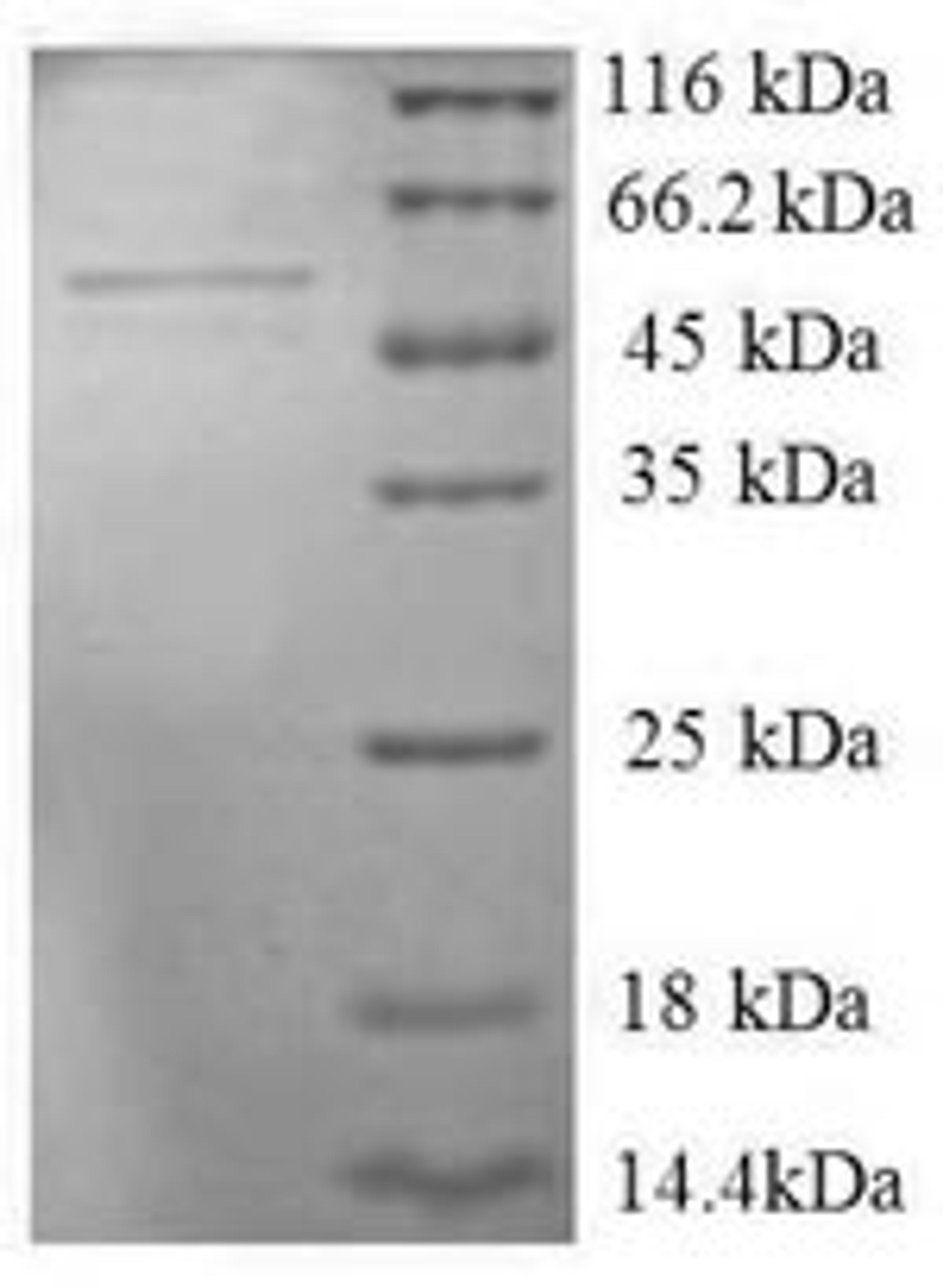 (Tris-Glycine gel) Discontinuous SDS-PAGE (reduced) with 5% enrichment gel and 15% separation gel.