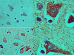 Immunohistochemistry-Paraffin: Brachyury Antibody [NBP2-24676] - Analysis of Brachyury in formalin-fixed, paraffin-embedded human brain tissue using an isotype control (top left) and this antibody (bottom left, right) at 5 ug/ml.