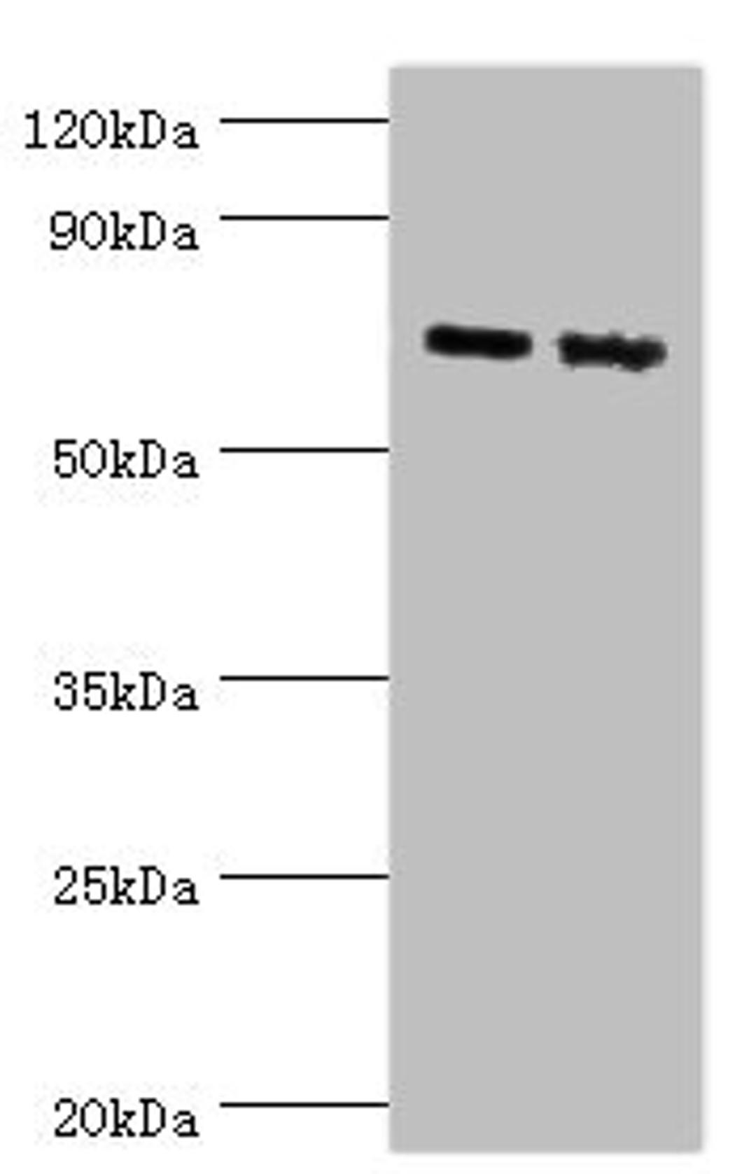 Western blot. All lanes: Amyloid-like protein 1 antibody at 6ug/ml. Lane 1: Mouse brain tissue. Lane 2: A549 whole cell lysate. Secondary. Goat polyclonal to rabbit IgG at 1/10000 dilution. Predicted band size: 72 kDa. Observed band size: 72 kDa. 