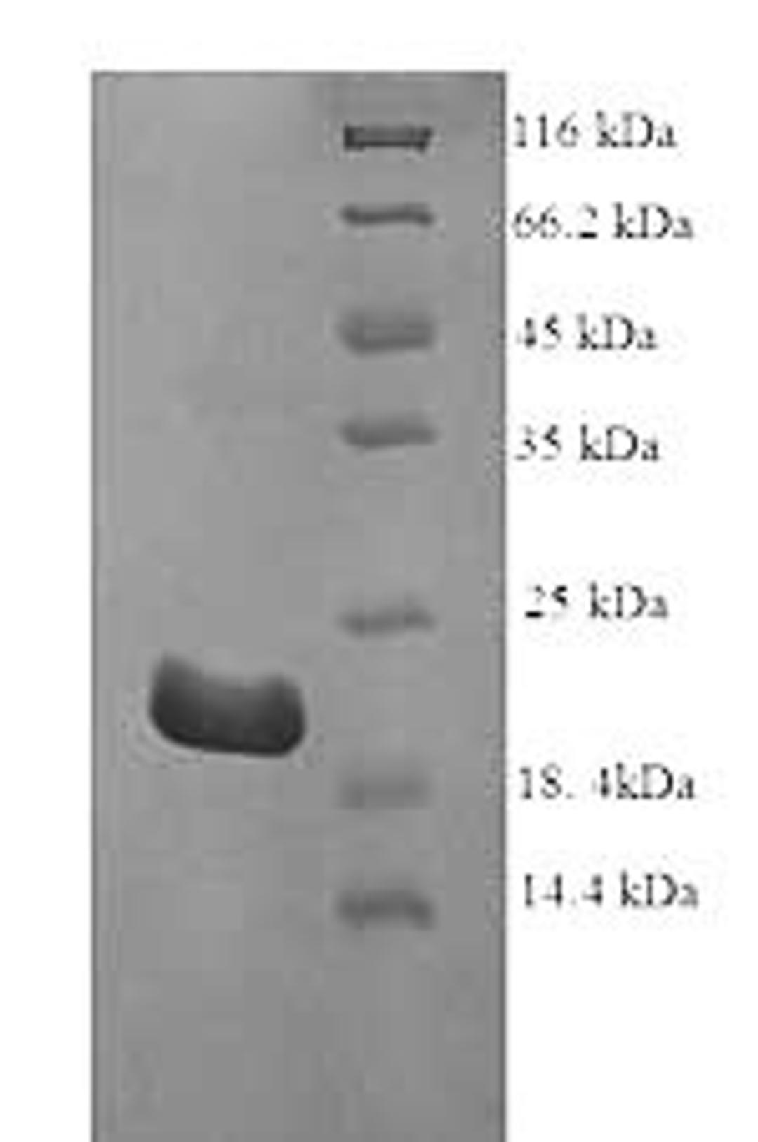 (Tris-Glycine gel) Discontinuous SDS-PAGE (reduced) with 5% enrichment gel and 15% separation gel.
