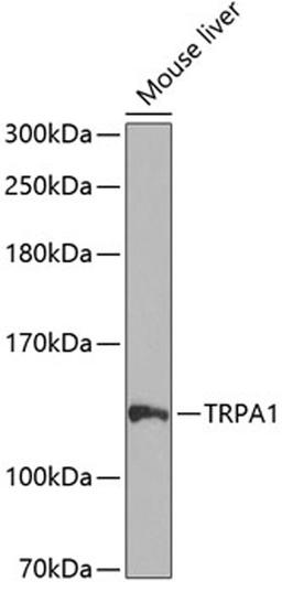 Western blot - TRPA1 antibody (A8568)